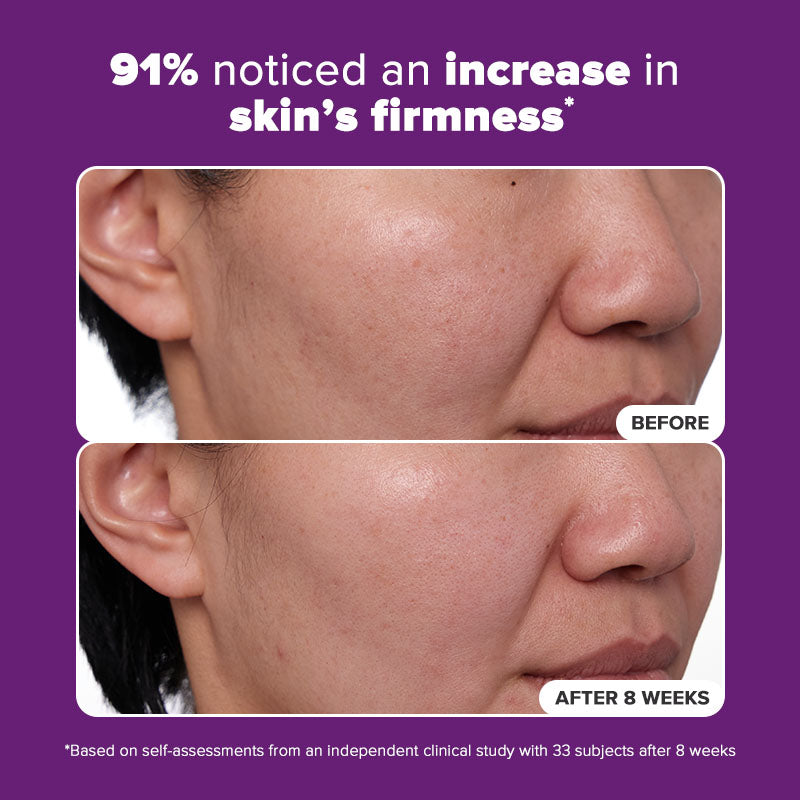 1% Retinol Treatment