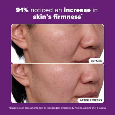 1% Retinol Treatment