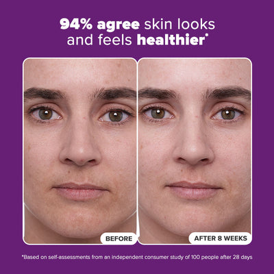 1% Retinol Treatment