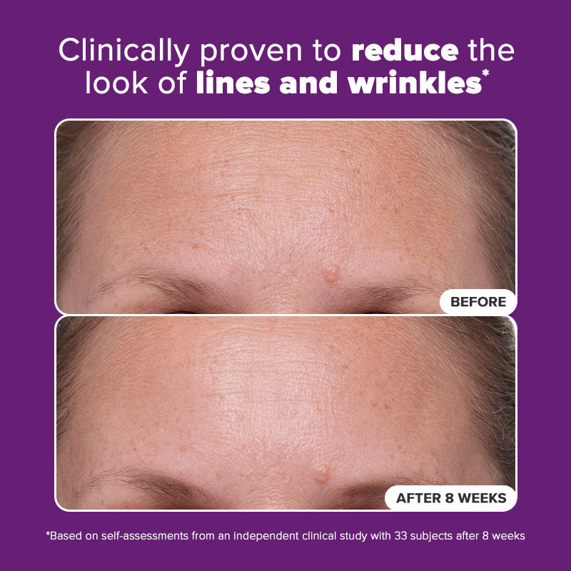 1% Retinol Treatment
