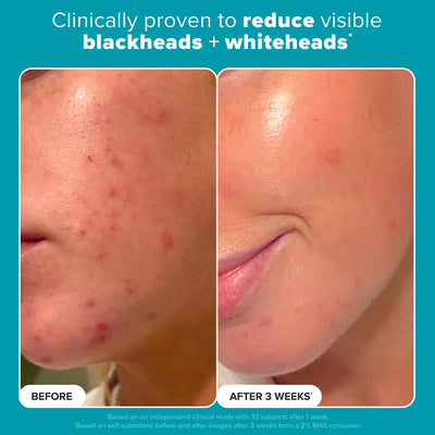 2% BHA Liquid Exfoliant Paula's Choice Thailand