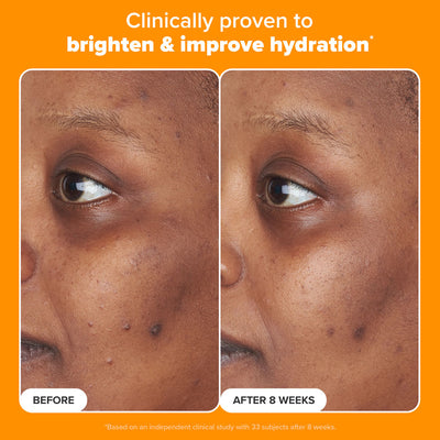 5% Vitamin C Sheer Moisturizer SPF 50