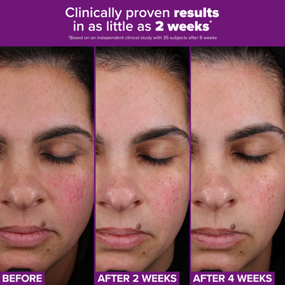 Pro-Clinical Retinaldehyde Treatment 30ML - Paula's Choice Thailand