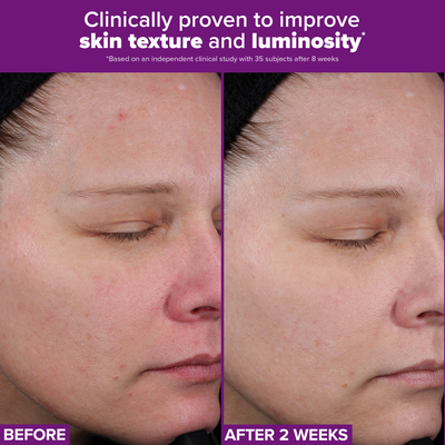 Pro-Clinical Retinaldehyde Treatment 30ML - Paula's Choice Thailand