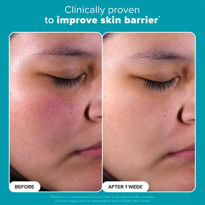 Skin Perfecting Jumbo 2% BHA Liquid Exfoliant 236ML - Paula's Choice Thailand