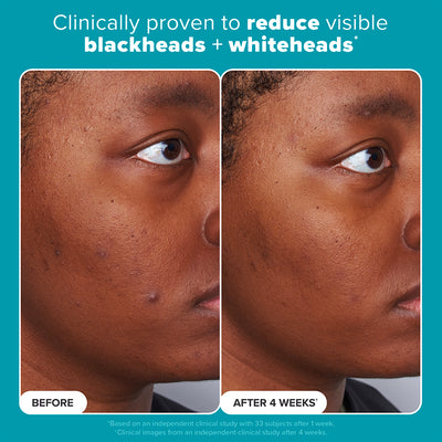 Skin Perfecting Jumbo 2% BHA Liquid Exfoliant 236ML - Paula's Choice Thailand